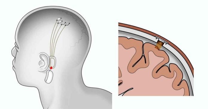 Elon Musk wants to stream music directly to your brain