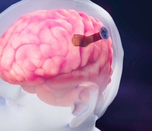 Layer 7 Cortical Interface Layer 7 Cortical Interface